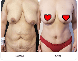 Before and after 6