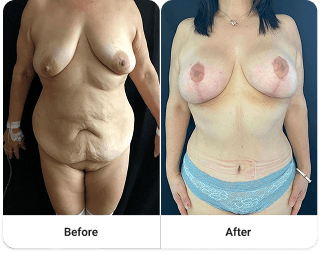 Before and after 9